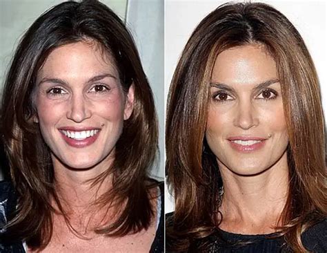 cindy crawford nose|Cindy Crawford Nose Job Plastic Surgery Before and After